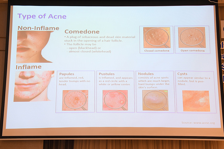 Social, La Roche-Posay, สมดุลแบคทีเรียบนผิว, หน้าใสไร้สิว, Skin Microbiome, Boots, บู๊ทส์, ลา โรช-โพเซย์, เวชสำอาง, แบรนด์ฝรั่งเศส, โรงแรมโฟร์วิงส์, บริษัท ลอรีอัล (ประเทศไทย) จำกัด, ศุภิสรา พสวงศ์, พญ. สุเพ็ญญา วโรทัย, มลฤดี เลิศอุทัย, เภสัชกรหญิงลักษณา ทรัพย์ชูกุล, ตระกูล ส่งพิริยะกิจ