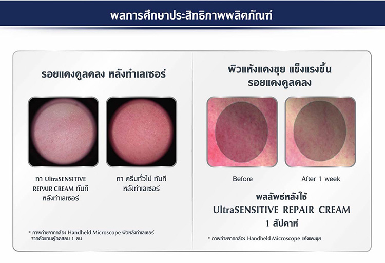 สกินแคร์ผิวแพ้ง่าย_Eucerin_Repair cream_04